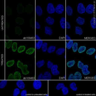 Immunocytochemistry/ Immunofluorescence - Anti-Histone H4 (acetyl K16) antibody [EPR1004] (AB109463), expandable thumbnail