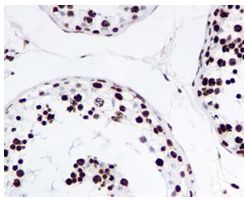 Immunohistochemistry (Formalin/PFA-fixed paraffin-embedded sections) - Anti-Histone H4 (acetyl K16) antibody [EPR1004] (ab109463), expandable thumbnail