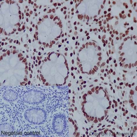 Immunohistochemistry (Formalin/PFA-fixed paraffin-embedded sections) - Anti-Histone H4 (acetyl K16) antibody [EPR1004] (ab109463), expandable thumbnail