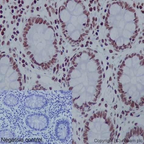 Immunohistochemistry (Formalin/PFA-fixed paraffin-embedded sections) - Anti-Histone H4 (acetyl K16) antibody [EPR1004] (ab109463), expandable thumbnail