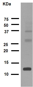 Western blot - Anti-Histone H4 (acetyl K16) antibody [EPR1004] (ab109463), expandable thumbnail