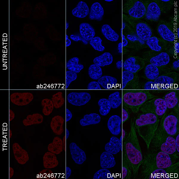 Immunocytochemistry/ Immunofluorescence - Anti-Histone H4 (acetyl K16) antibody [EPR1004] - BSA and Azide free (AB194352)