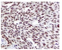 Immunohistochemistry (Formalin/PFA-fixed paraffin-embedded sections) - Anti-Histone H4 (acetyl K16) antibody [EPR1004] - BSA and Azide free (AB194352)