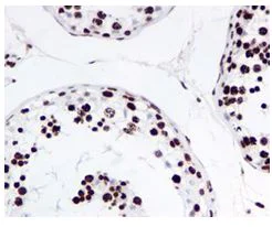 Immunohistochemistry (Formalin/PFA-fixed paraffin-embedded sections) - Anti-Histone H4 (acetyl K16) antibody [EPR1004] - BSA and Azide free (AB194352)
