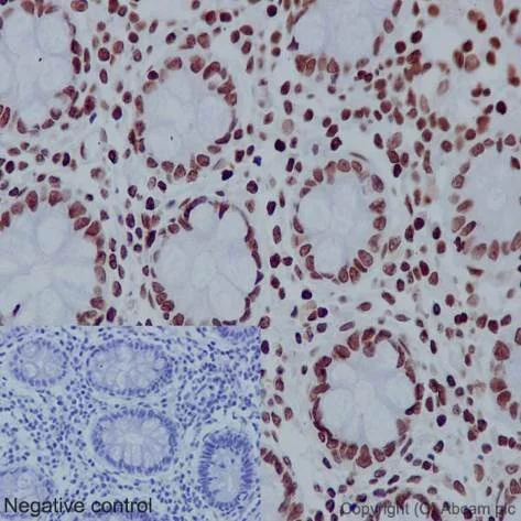 Immunohistochemistry (Formalin/PFA-fixed paraffin-embedded sections) - Anti-Histone H4 (acetyl K16) antibody [EPR1004] - BSA and Azide free (AB194352)