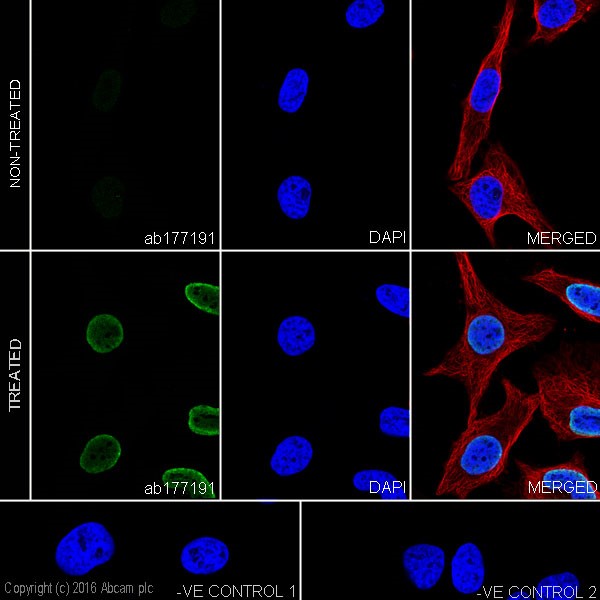 Immunocytochemistry/ Immunofluorescence - Anti-Histone H4 (acetyl K20) antibody [EPR16998(2)] - ChIP Grade (AB177191)