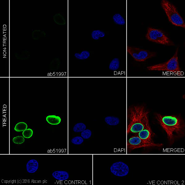 Immunocytochemistry/ Immunofluorescence - Anti-Histone H4 (acetyl K5) antibody [EP1000Y] - BSA and Azide free (AB232507)