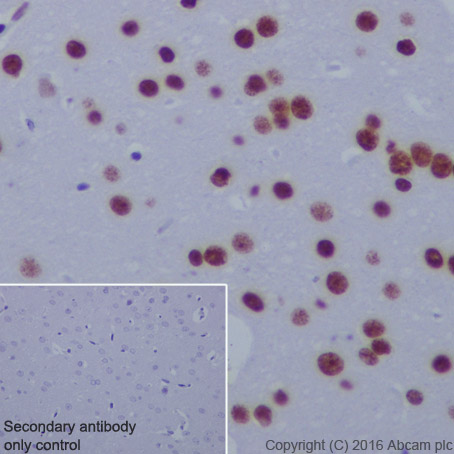 Immunohistochemistry (Formalin/PFA-fixed paraffin-embedded sections) - Anti-Histone H4 (acetyl K5) antibody [EP1000Y] - BSA and Azide free (ab232507), expandable thumbnail