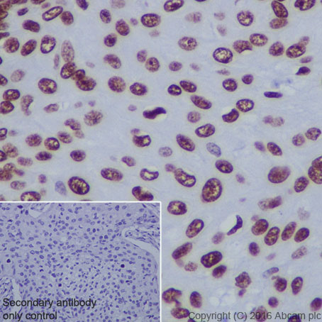 Immunohistochemistry (Formalin/PFA-fixed paraffin-embedded sections) - Anti-Histone H4 (acetyl K5) antibody [EP1000Y] - BSA and Azide free (ab232507), expandable thumbnail