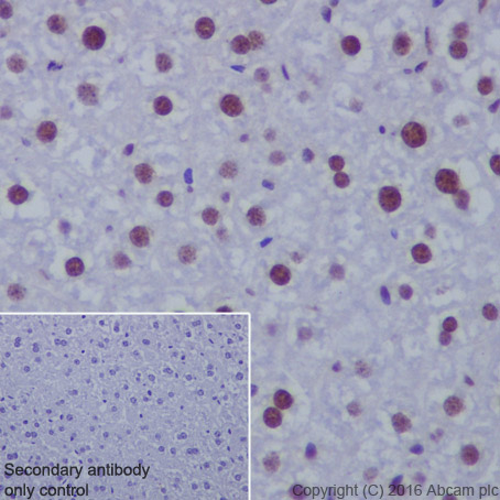 Immunohistochemistry (Formalin/PFA-fixed paraffin-embedded sections) - Anti-Histone H4 (acetyl K5) antibody [EP1000Y] - BSA and Azide free (AB232507), expandable thumbnail