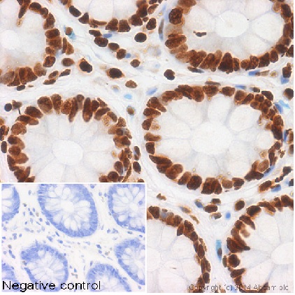 Immunohistochemistry (Formalin/PFA-fixed paraffin-embedded sections) - Anti-Histone H4 (acetyl K5) antibody [EP1000Y] - BSA and Azide free (AB232507), expandable thumbnail