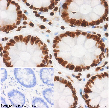 Immunohistochemistry (Formalin/PFA-fixed paraffin-embedded sections) - Anti-Histone H4 (acetyl K5) antibody [EP1000Y] - BSA and Azide free (AB232507)