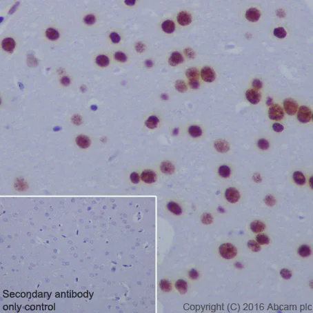 Immunohistochemistry (Formalin/PFA-fixed paraffin-embedded sections) - Anti-Histone H4 (acetyl K5) antibody [EP1000Y] - ChIP Grade (AB51997)