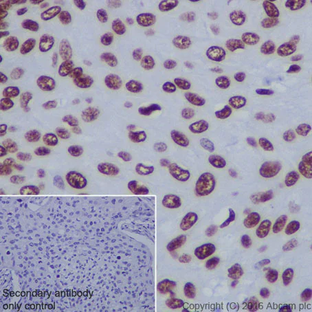 Immunohistochemistry (Formalin/PFA-fixed paraffin-embedded sections) - Anti-Histone H4 (acetyl K5) antibody [EP1000Y] - ChIP Grade (AB51997)