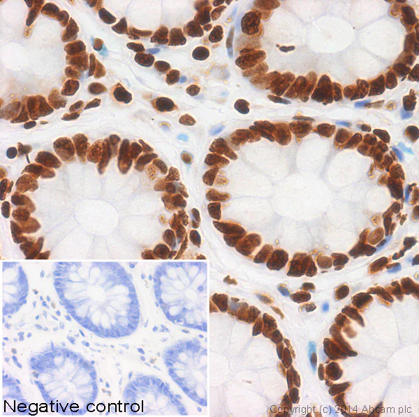 Anti-Histone H4 (acetyl K5) antibody [EP1000Y] - ChIP Grade