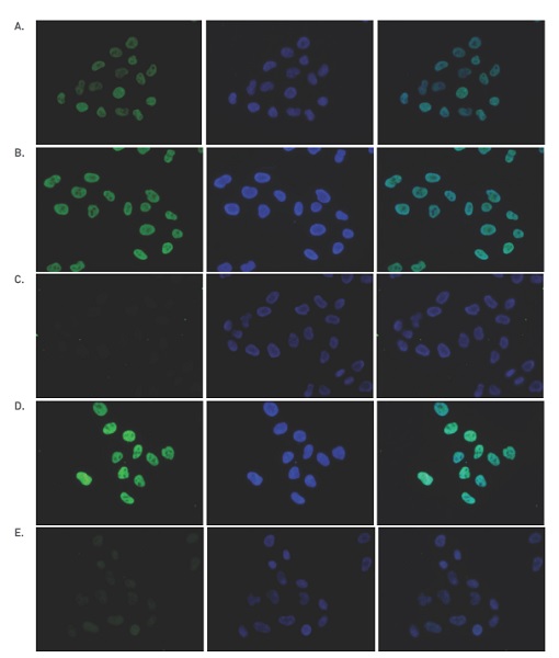 Immunocytochemistry/ Immunofluorescence - Anti-Histone H4 (acetyl K5 + K8 + K12) antibody (AB233193), expandable thumbnail