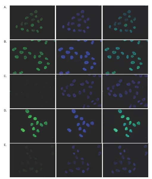 Immunocytochemistry/ Immunofluorescence - Anti-Histone H4 (acetyl K5 + K8 + K12) antibody (AB233193)