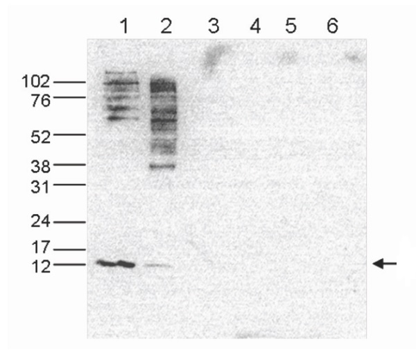 Western blot - Anti-Histone H4 (acetyl K5 + K8 + K12) antibody (AB233193), expandable thumbnail