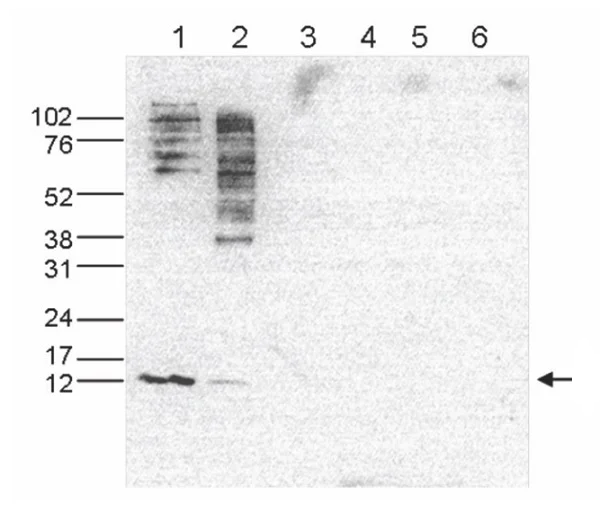 Western blot - Anti-Histone H4 (acetyl K5 + K8 + K12) antibody (AB233193)