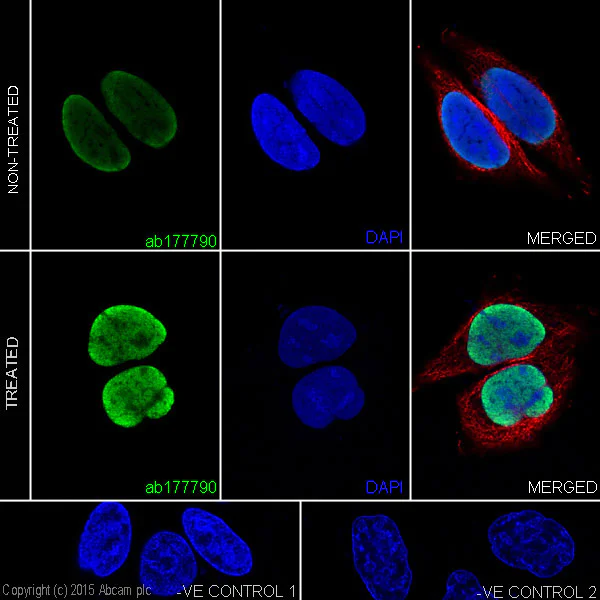 Immunocytochemistry/ Immunofluorescence - Anti-Histone H4 (acetyl K5 + K8 + K12 + K16) antibody [EPR16606] (AB177790)