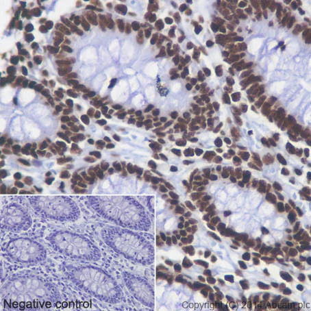 Immunohistochemistry (Formalin/PFA-fixed paraffin-embedded sections) - Anti-Histone H4 (acetyl K5 + K8 + K12 + K16) antibody [EPR16606] (AB177790)