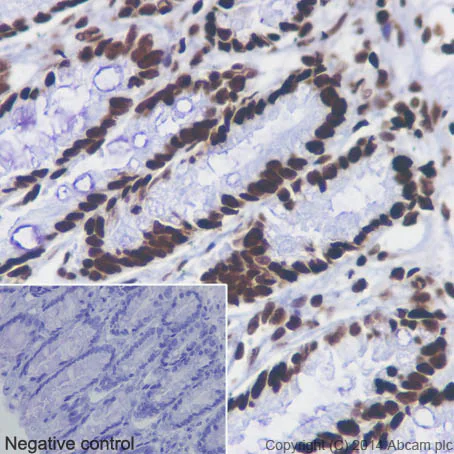 Immunohistochemistry (Formalin/PFA-fixed paraffin-embedded sections) - Anti-Histone H4 (acetyl K5 + K8 + K12 + K16) antibody [EPR16606] (AB177790)