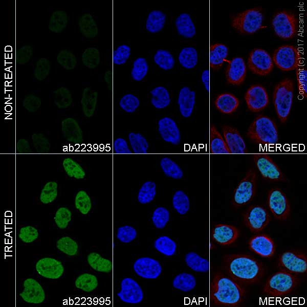 Immunocytochemistry/ Immunofluorescence - Anti-Histone H4 (acetyl K5 + K8 + K12 + K16) antibody [EPR16606] - BSA and Azide free (AB240201), expandable thumbnail