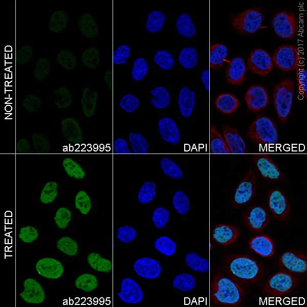 Immunocytochemistry/ Immunofluorescence - Anti-Histone H4 (acetyl K5 + K8 + K12 + K16) antibody [EPR16606] - BSA and Azide free (AB240201)