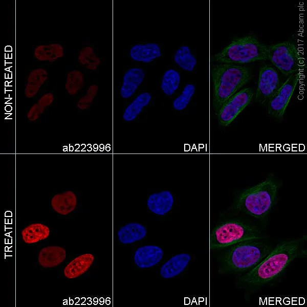 Immunocytochemistry/ Immunofluorescence - Anti-Histone H4 (acetyl K5 + K8 + K12 + K16) antibody [EPR16606] - BSA and Azide free (AB240201)