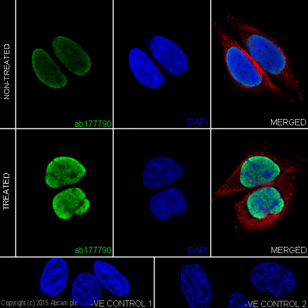 Immunocytochemistry/ Immunofluorescence - Anti-Histone H4 (acetyl K5 + K8 + K12 + K16) antibody [EPR16606] - BSA and Azide free (AB240201), expandable thumbnail