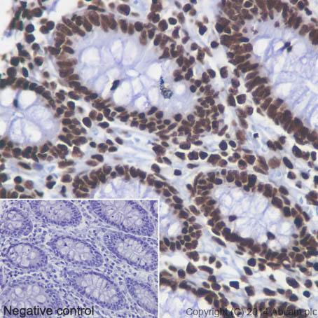 Immunohistochemistry (Formalin/PFA-fixed paraffin-embedded sections) - Anti-Histone H4 (acetyl K5 + K8 + K12 + K16) antibody [EPR16606] - BSA and Azide free (AB240201), expandable thumbnail