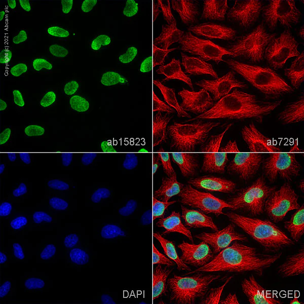 Immunocytochemistry/ Immunofluorescence - Anti-Histone H4 (acetyl K8) antibody - ChIP Grade (AB15823)