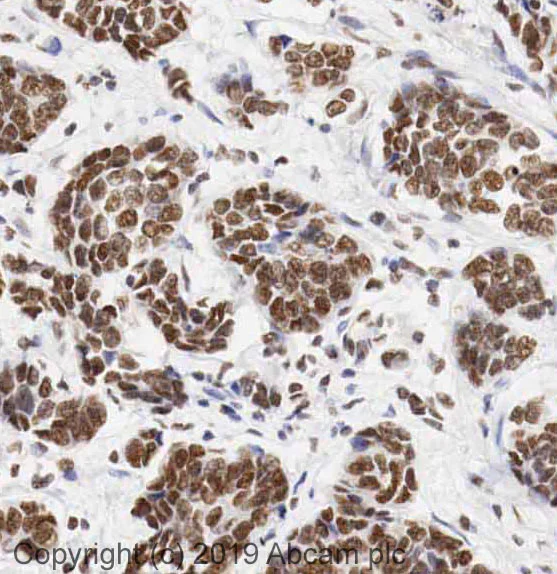 Immunohistochemistry (Formalin/PFA-fixed paraffin-embedded sections) - Anti-Histone H4 (acetyl K8) antibody - ChIP Grade (AB15823)