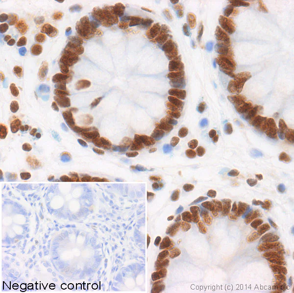 Immunohistochemistry (Formalin/PFA-fixed paraffin-embedded sections) - Anti-Histone H4 (acetyl K8) antibody [EP1002Y] - BSA and Azide free (AB171184)