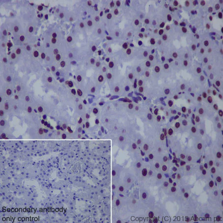 Immunohistochemistry (Formalin/PFA-fixed paraffin-embedded sections) - Anti-Histone H4 (acetyl K8) antibody [EP1002Y] - BSA and Azide free (AB171184)