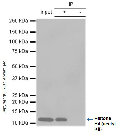 Immunoprecipitation - Anti-Histone H4 (acetyl K8) antibody [EP1002Y] - BSA and Azide free (AB171184)