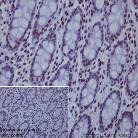 Immunohistochemistry (Formalin/PFA-fixed paraffin-embedded sections) - Anti-Histone H4 (acetyl K8) antibody [EP1002Y] - ChIP Grade (AB45166)