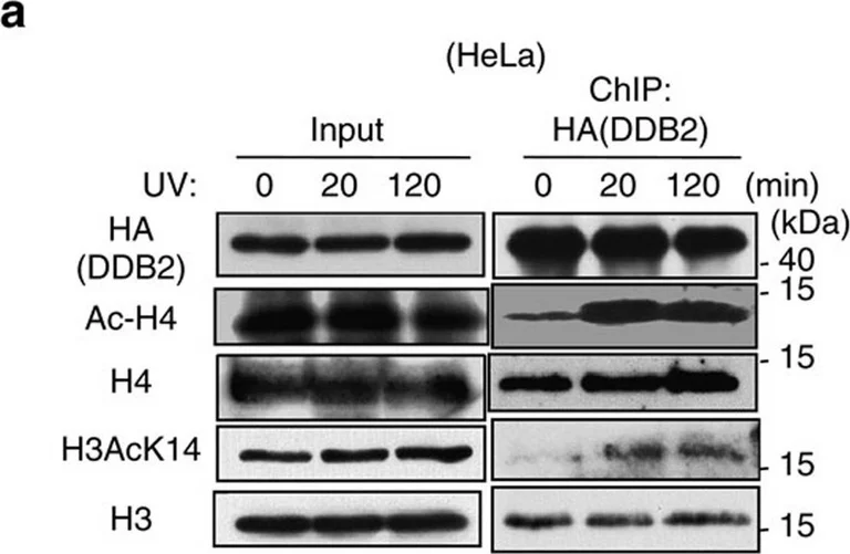 Western blot - Anti-Histone H4 antibody - ChIP Grade (AB10158)