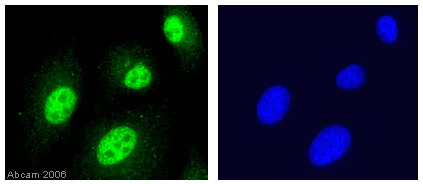 Immunocytochemistry/ Immunofluorescence - Anti-Histone H4 antibody - ChIP Grade (AB7311)