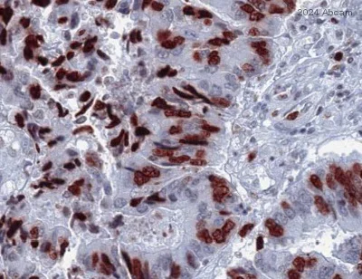 Immunohistochemistry (Formalin/PFA-fixed paraffin-embedded sections) - Anti-Histone H4 antibody - ChIP Grade (AB7311)
