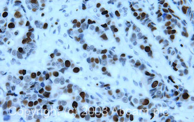 Immunohistochemistry (Formalin/PFA-fixed paraffin-embedded sections) - Anti-Histone H4 antibody - ChIP Grade (AB7311)
