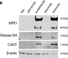 Western blot - Anti-Histone H4 antibody [mAbcam 17036] - ChIP Grade (AB17036)