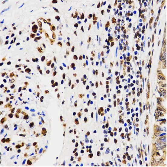Immunohistochemistry (Formalin/PFA-fixed paraffin-embedded sections) - Anti-Histone H4 (asymmetric di methyl R3) antibody (AB194683)