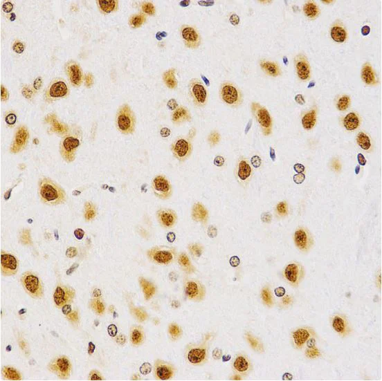 Immunohistochemistry (Formalin/PFA-fixed paraffin-embedded sections) - Anti-Histone H4 (asymmetric di methyl R3) antibody (AB194683)