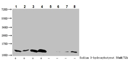 Western blot - Anti-Histone H4 (beta-hydroxybutyryl K5) antibody (AB243246)