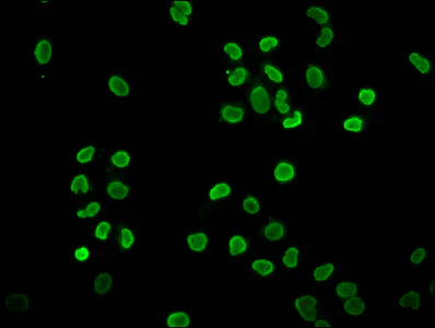 Immunocytochemistry/ Immunofluorescence - Anti-Histone H4 (butyryl K12) antibody (AB241120)