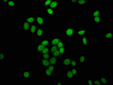 Immunocytochemistry/ Immunofluorescence - Anti-Histone H4 (butyryl K16) antibody (AB240615)