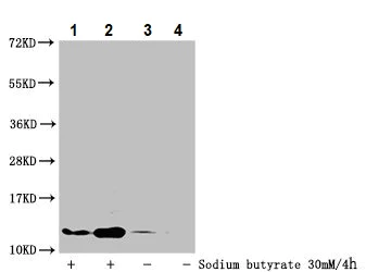 Western blot - Anti-Histone H4 (butyryl K16) antibody (AB240615)
