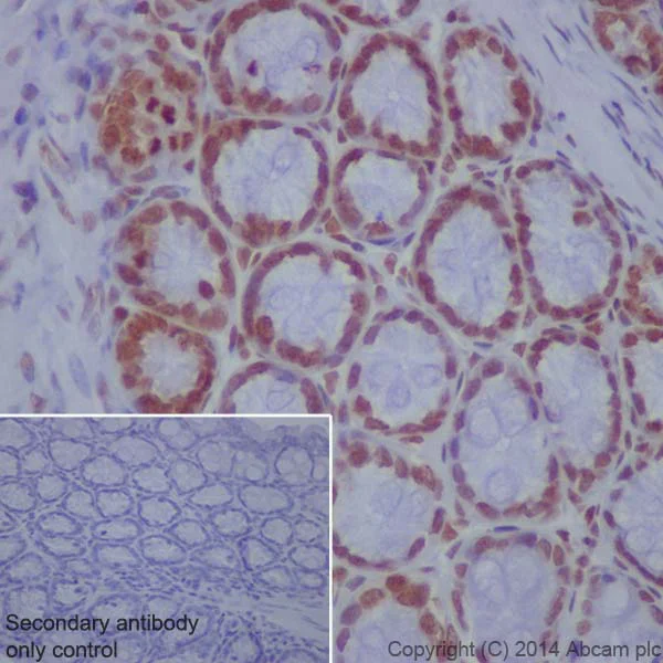 Immunohistochemistry (Formalin/PFA-fixed paraffin-embedded sections) - Anti-Histone H4 (crotonyl K8) antibody [EPR17905(R)] - BSA and Azide free (AB251336)