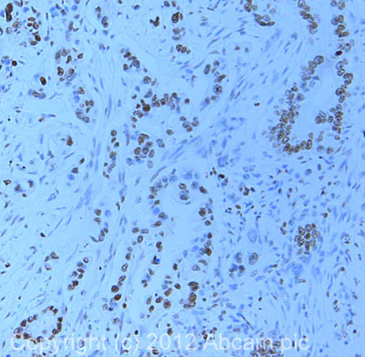 Immunohistochemistry (Formalin/PFA-fixed paraffin-embedded sections) - Anti-Histone H4 (di methyl K20) antibody (AB9052)